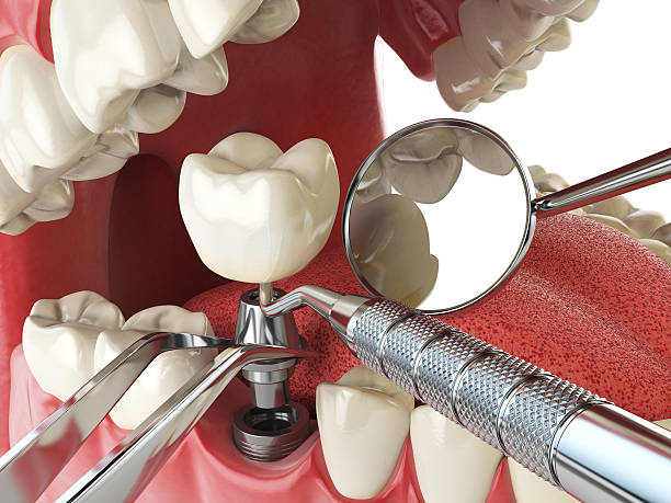 Best Emergency Broken Tooth Repair in Holbrook, NY